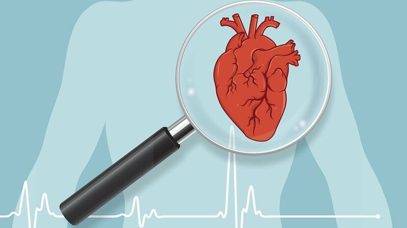 Thiếu máu cơ tim cục bộ: Nguyên nhân, triệu chứng và cách điều trị 1
