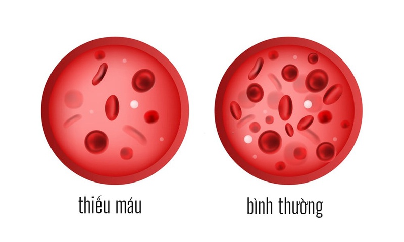 Vitamin C có vai trò gì trong cơ thể của chúng ta? 4