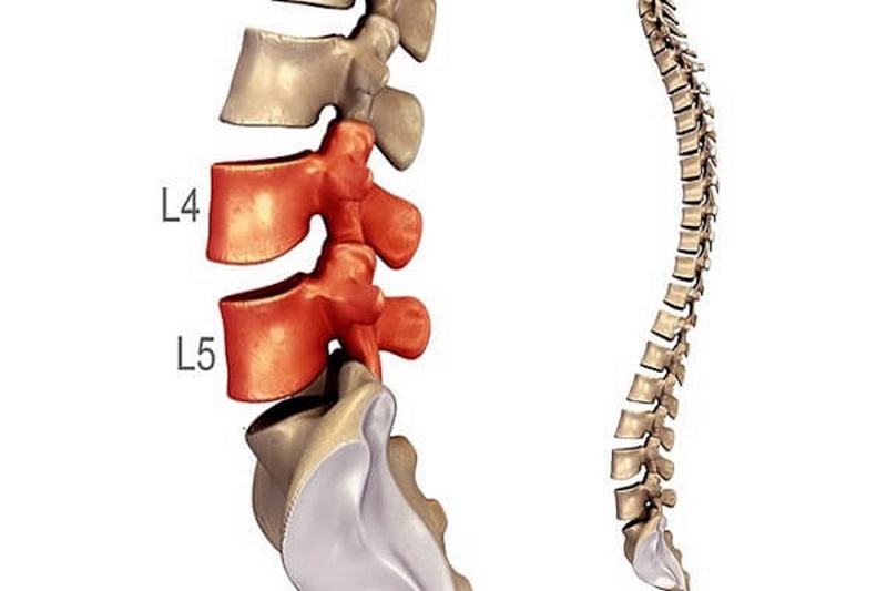 Thoát vị đĩa đệm L4 L5 là một tình trạng trong đó nhân của niêm mạc đĩa đệm bị vỡ ra khỏi vị trí bình thường