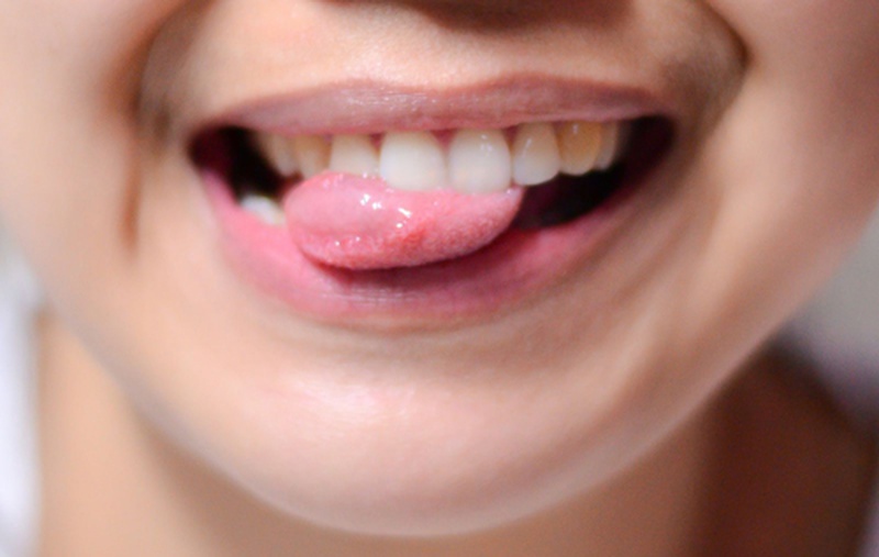 Thói quen xấu ảnh hưởng đến răng miệng 2