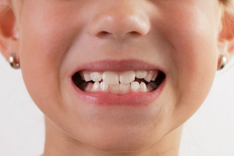 Thói quen xấu ảnh hưởng đến răng miệng 4