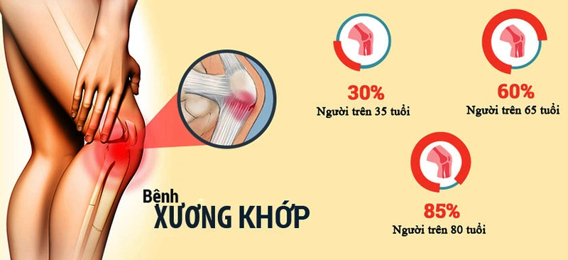 Thông tin viên uống bổ sung Canxi, giảm nguy cơ loãng xương Pharma Word Calci K-2 60V 2