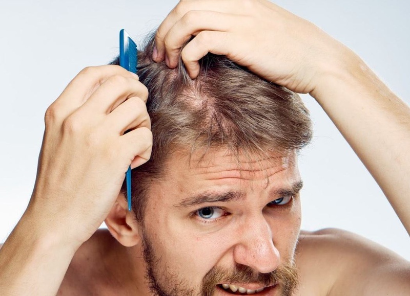 Thực hư thảo dược trắc bá diệp trị rụng tóc ở nam giới 2
