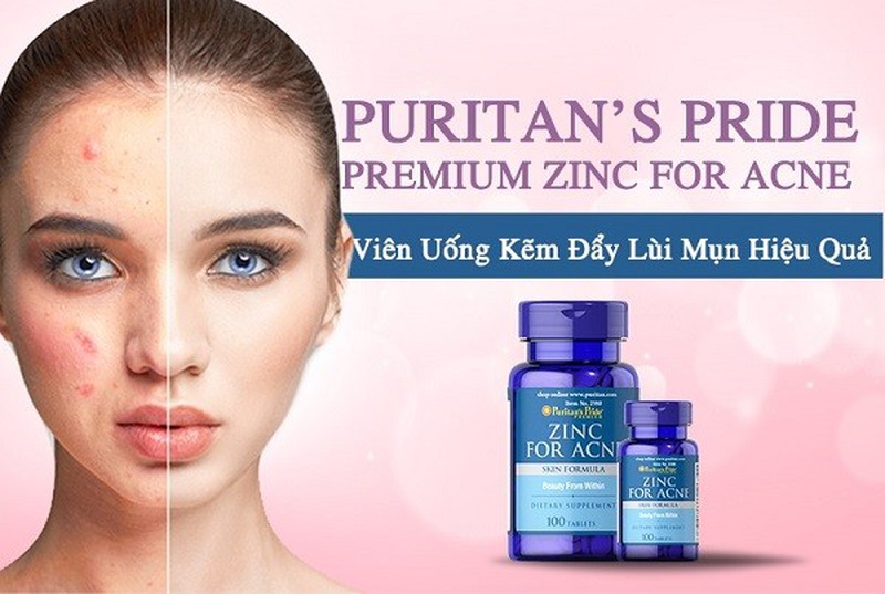 Thuốc bổ sung kẽm trị mụn loại nào tốt và nên dùng thế nào? 4