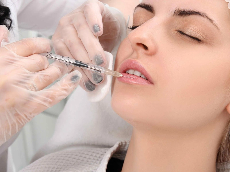 Những điều cần biết về tiêm filler môi baby 1