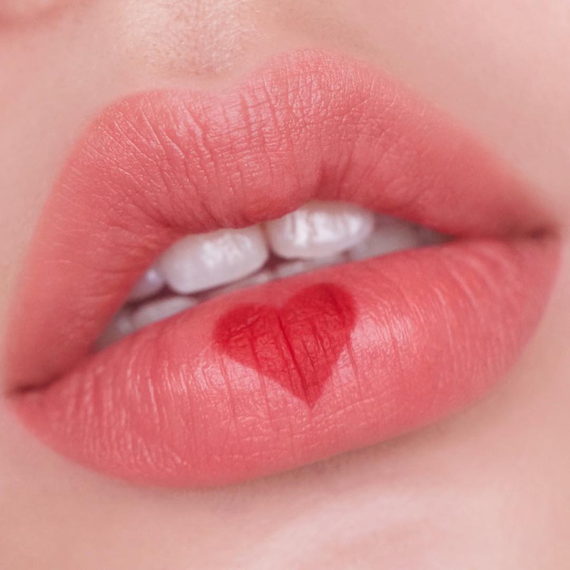 Hạn chế dùng son môi sau khi tiêm filler