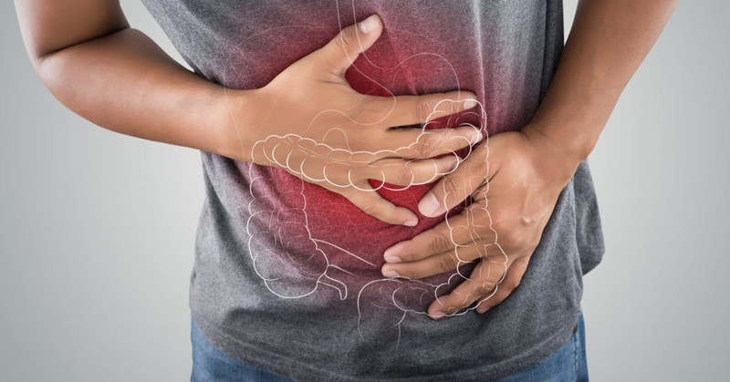 Viêm loét đại tràng là bệnh lý gây đau nhức, khó chịu ở vùng bụng