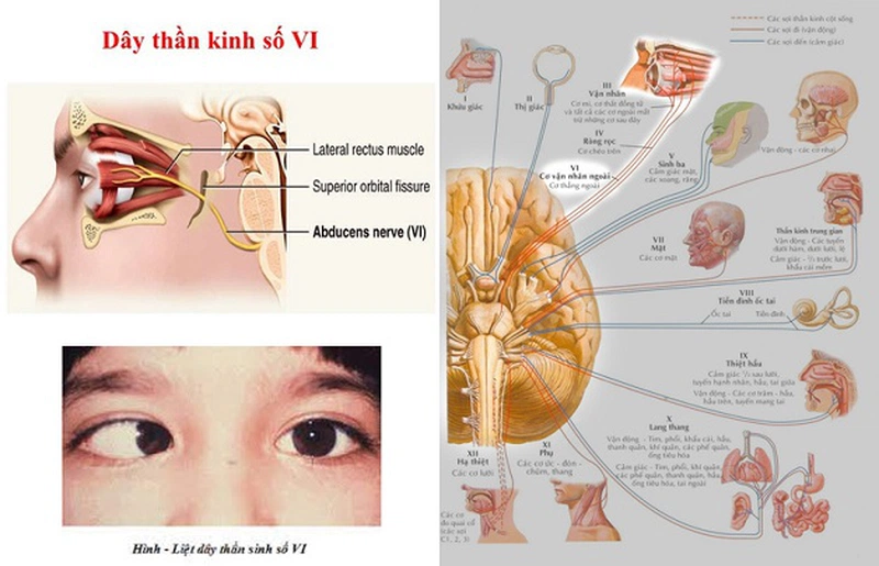 Tìm hiểu về thần kinh sọ: 12 đôi dây thần kinh sọ3