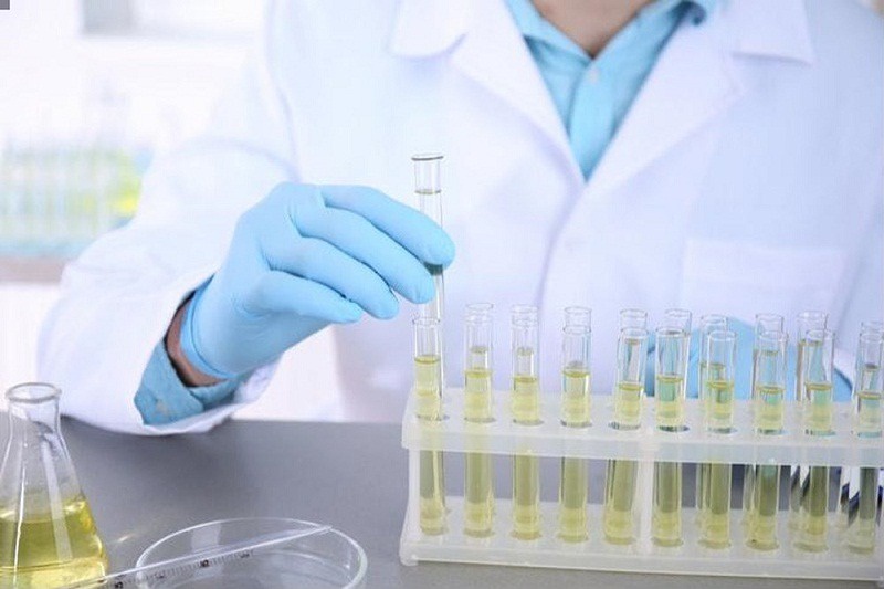 10 Thông số nước tiểu trong xét nghiệm có ý nghĩa gì? 1