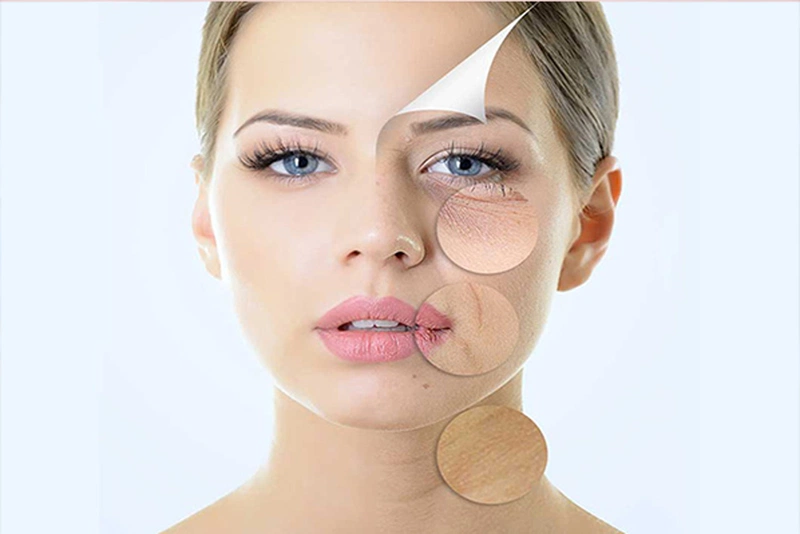 Tình dầu trầm hương có công dụng trị mụn, hồi phục da