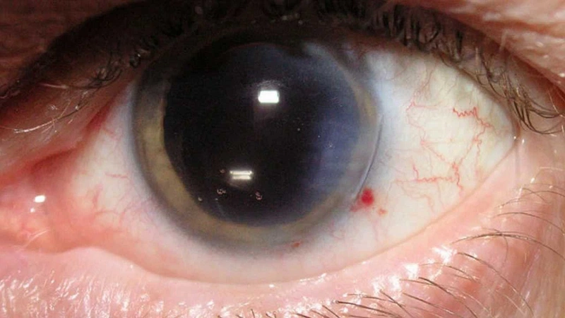 10 dấu hiệu cảnh báo tình trạng bất ổn của mắt bạn nên biết 2