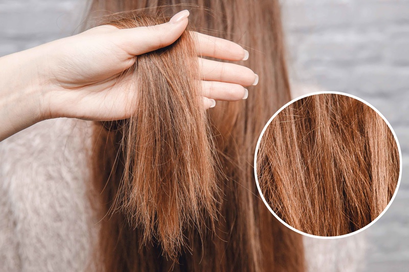 Mách bạn 3 cách phục hồi tóc hư tổn cho từng vấn đề tóc 2