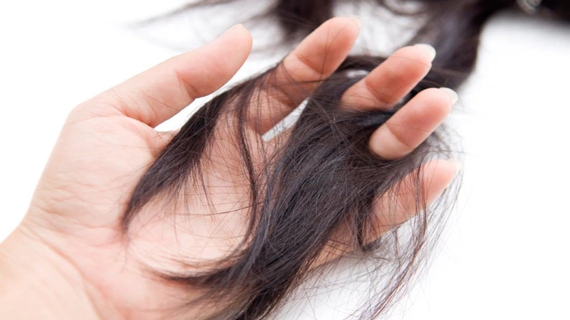 Tóc rụng bao nhiêu thì là bình thường 1