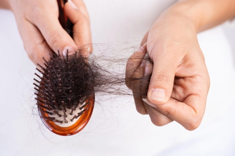 Tóc rụng nhiều là bệnh gì - Dấu hiệu cảnh báo các căn bệnh nguy hiểm! 1