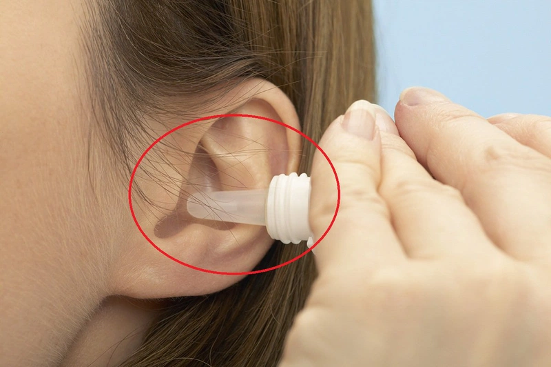 Hướng dẫn cách chữa viêm tai ngoài cho bà bầu an toàn, hiệu quả 2
