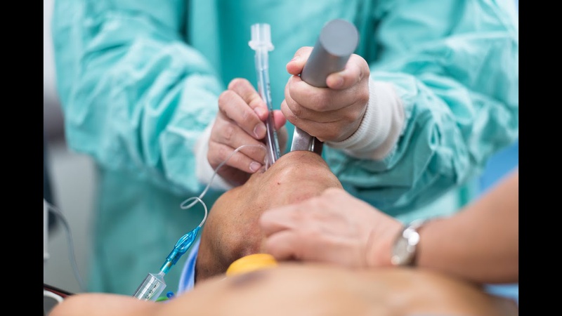 Tổng hợp các thông tin hữu ích về tầm soát ung thư phổi  3