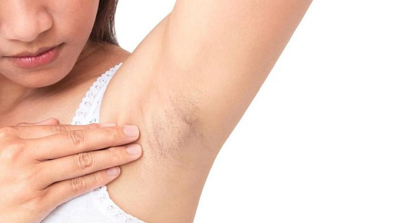 Sự gia tăng estrogen và progesterone trong thai kỳ khiến cho nhiệt độ cơ thể tăng lên dẫn đến tiết nhiều mồ hôi