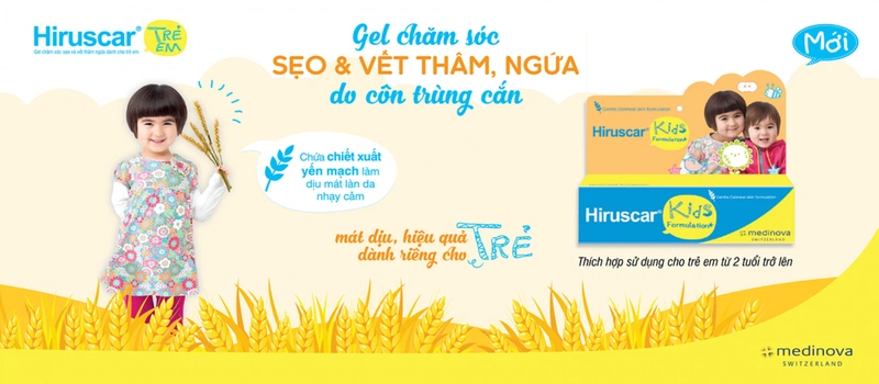  Top 6 kem trị sẹo bỏng cho bé  tốt nhất-4