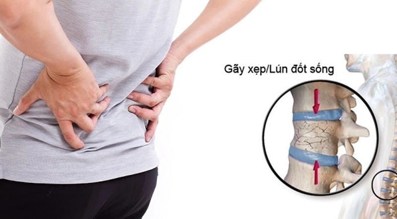 Top 8 bài tập chữa xẹp đốt sống nên thử-1