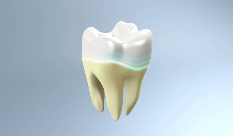 Ưu điểm của phương pháp tráng men răng