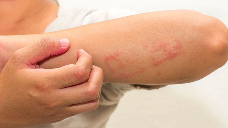 Trangala là thuốc gì? Những điều lưu ý khi sử dụng thuốc Trangala 2