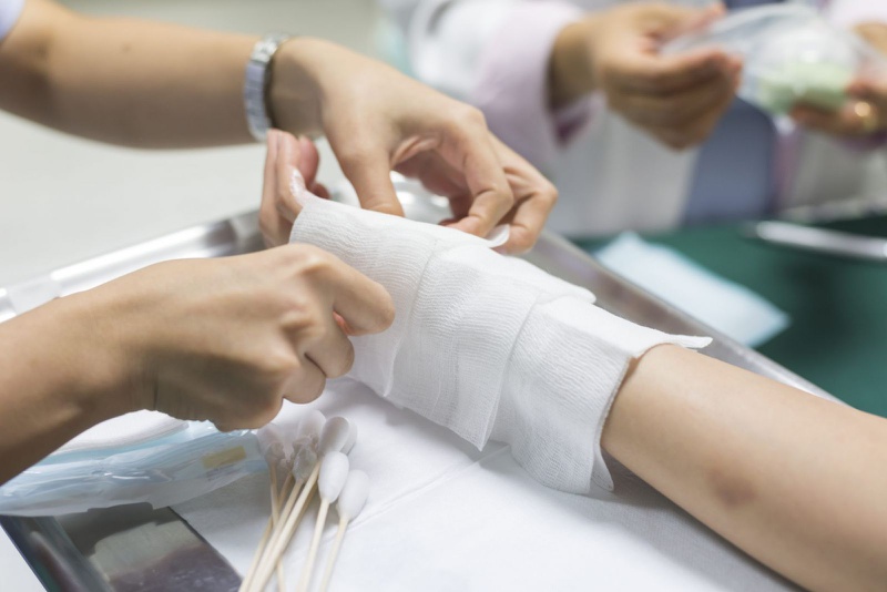 Tránh mắc những sai lầm khi xử lý bỏng tại nhà