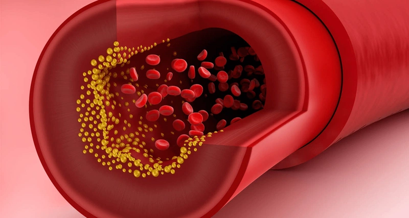 Dùng thuốc tránh thai có thể tăng cholesterol