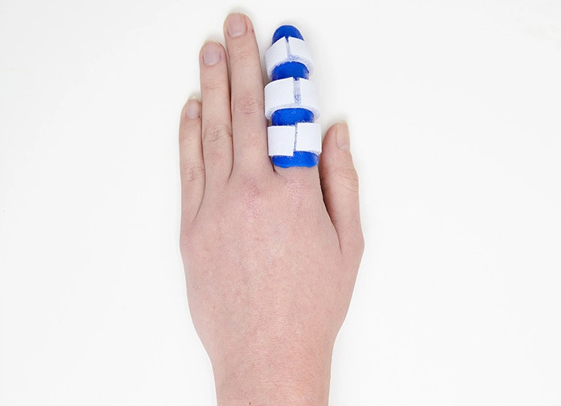 Điều trị trật khớp ngón tay bằng phương pháp nẹp