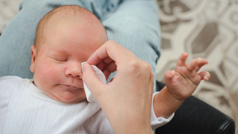 Trẻ sơ sinh bị đau mắt có ghèn: Nguyên nhân và vệ sinh mắt đúng cách 3