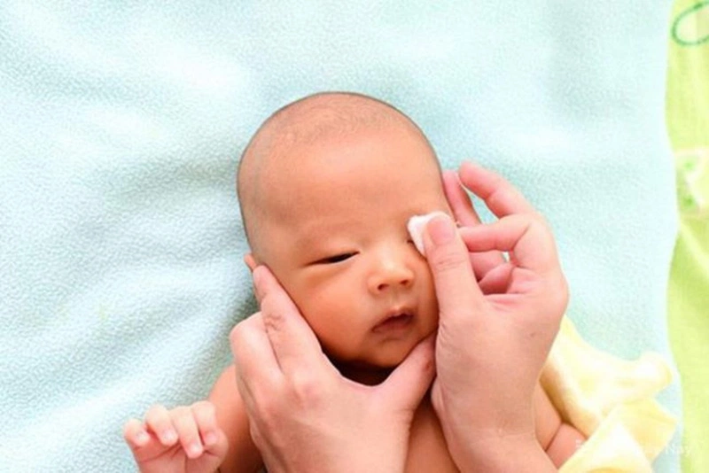 Trẻ sơ sinh bị đau mắt dùng thuốc gì mau khỏi? 2