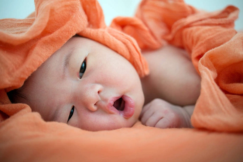 Trẻ sơ sinh rụng lông mày do sinh lý hay bệnh lý?-1