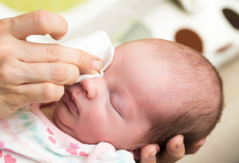 trẻ sơ sinh bị vàng da vàng mắt khá nguy hiểm nên phụ huynh không nên chủ quan