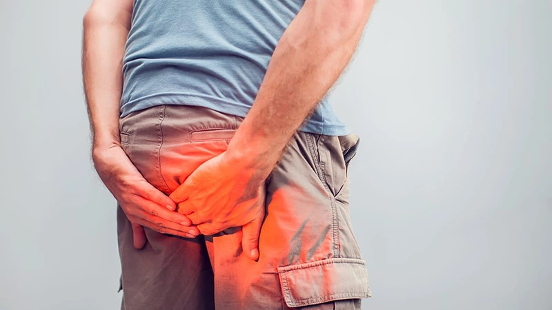 Trĩ là gì? Khi nào nên cắt trĩ bằng phương pháp HCPT? 2