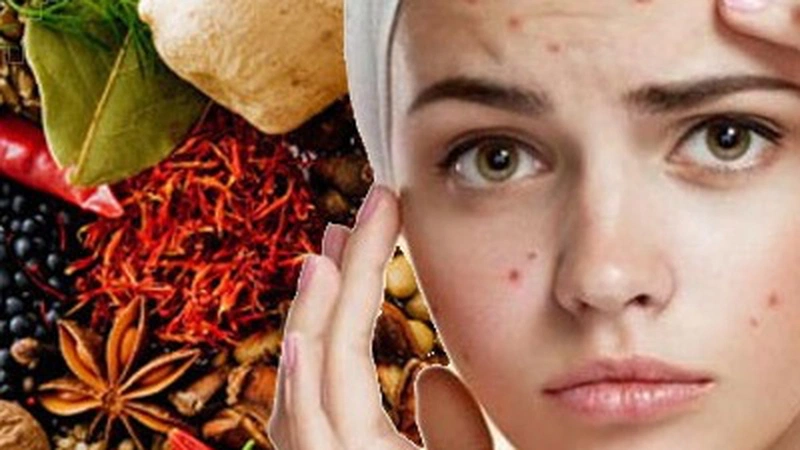 Dùng thuốc Đông y trị mụn có thực sự đem lại hiệu quả không? 1