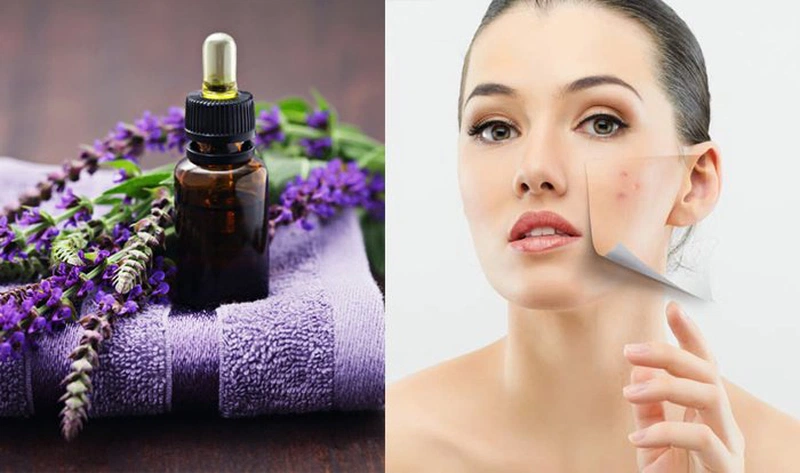 Công dụng thần kỳ của tinh dầu hoa Lavender với sức khỏe và làn da 3