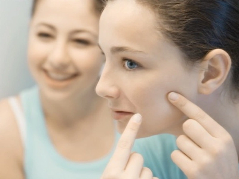 trị sẹo rỗ bằng retinol 4