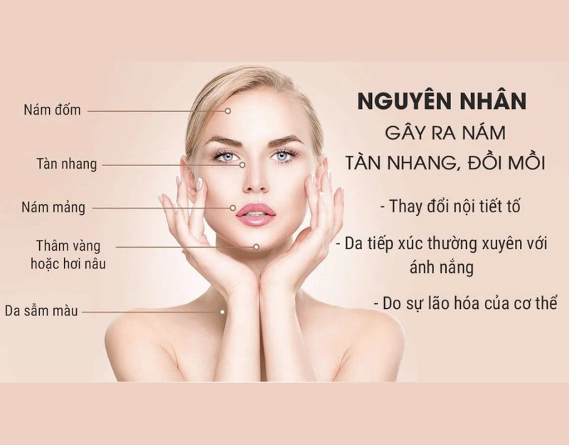Trị tàn nhang bằng thuốc Đông y có tốt không? 2