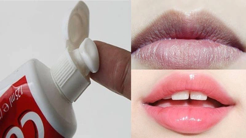 Trị thâm môi bằng kem đánh răng có hiệu quả không?
