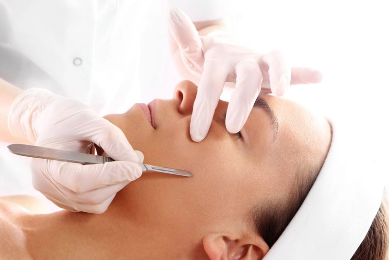 Triệt lông mặt có tốt không? 2