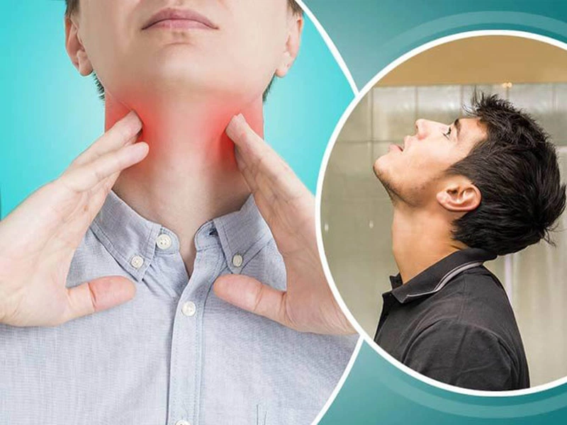 Triệu chứng bệnh viêm dây thanh quản 3