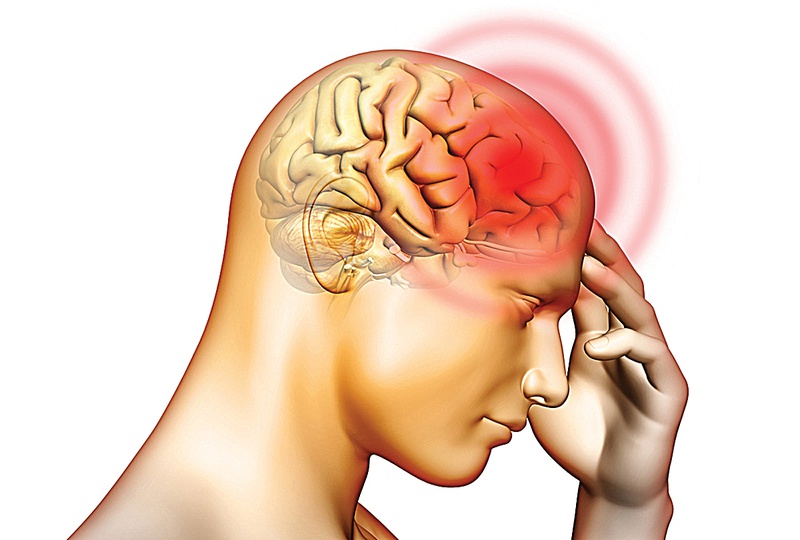 Những triệu chứng chấn thương sọ não điển hình 1