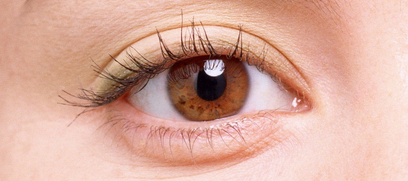 Những triệu chứng đau mắt đỏ dễ nhận biết nhất 1