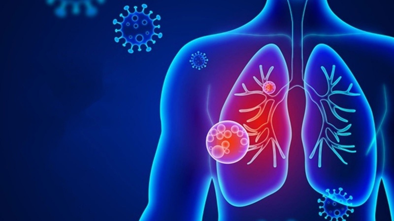 Triệu chứng khó thở hụt hơi: Nguyên nhân, điều trị và cách phòng ngừa 1