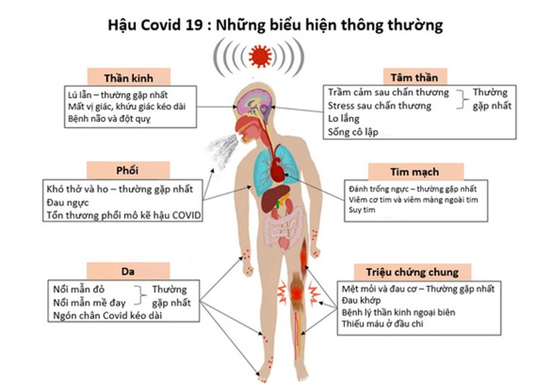 Hội chứng 'Covid kéo dài' vẫn còn bí ẩn 1