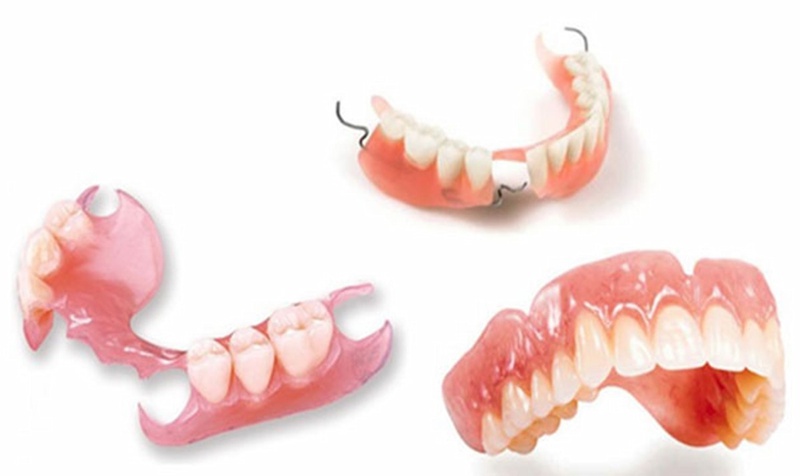 Trồng răng giá bao nhiêu? Cần lưu ý những gì khi đi trồng răng?2