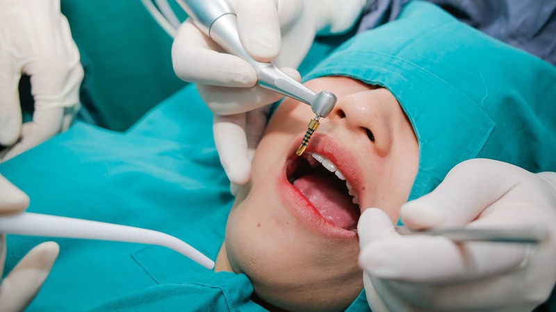 Trồng răng bằng cấy ghép implant có thật sự tốt? 2