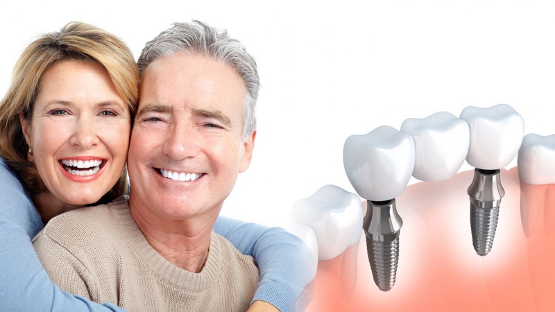 Trồng răng Implant có đau không? 1