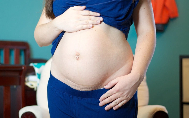 Trường hợp có thai sau sinh mổ 15 tháng có sao không 1