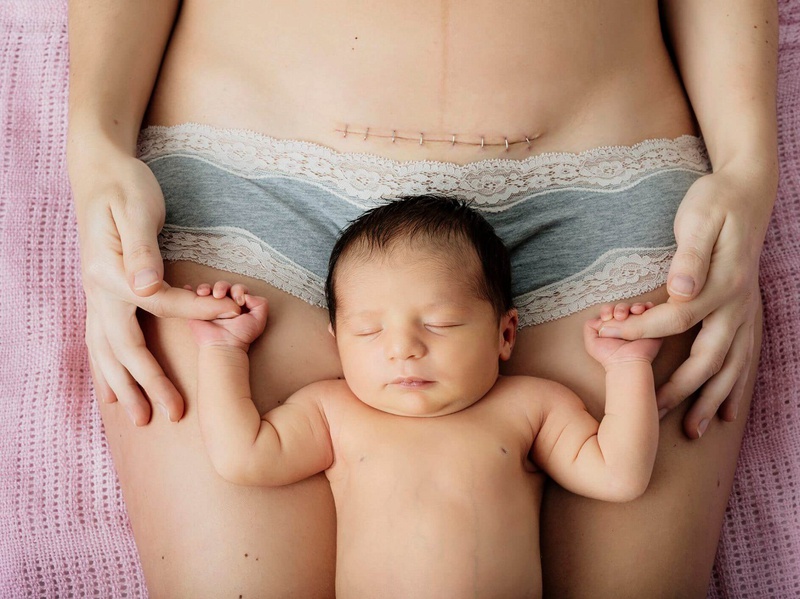 Trường hợp có thai sau sinh mổ 15 tháng có sao không 2