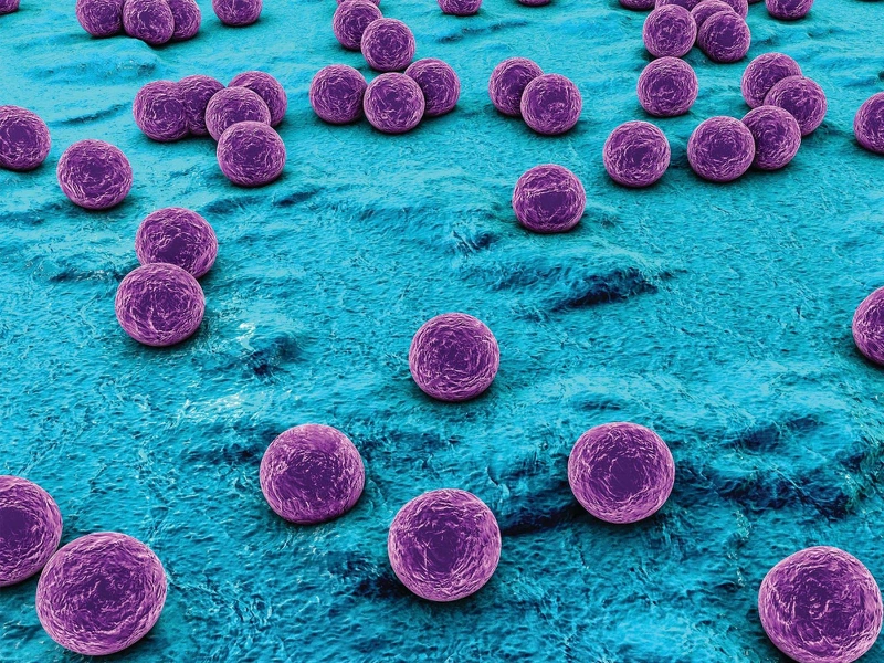6 bệnh nhiễm trùng da do vi khuẩn bạn cần biết 1